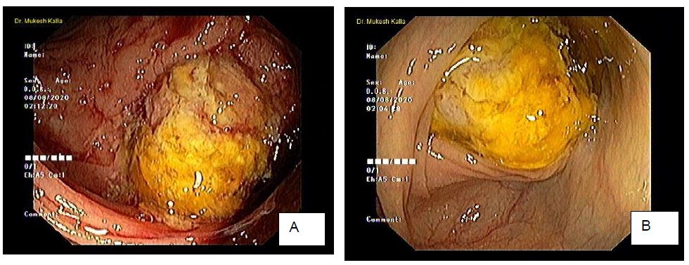 ijcgh1009-figure1