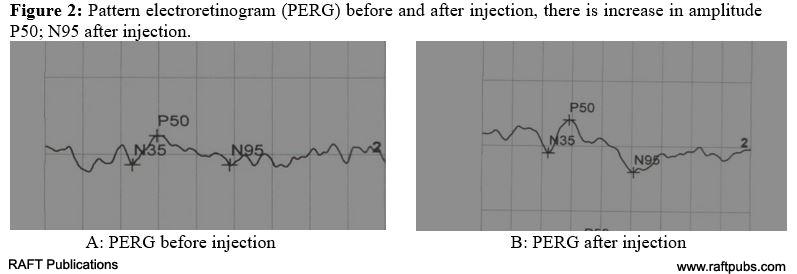 irjo1009_figure2