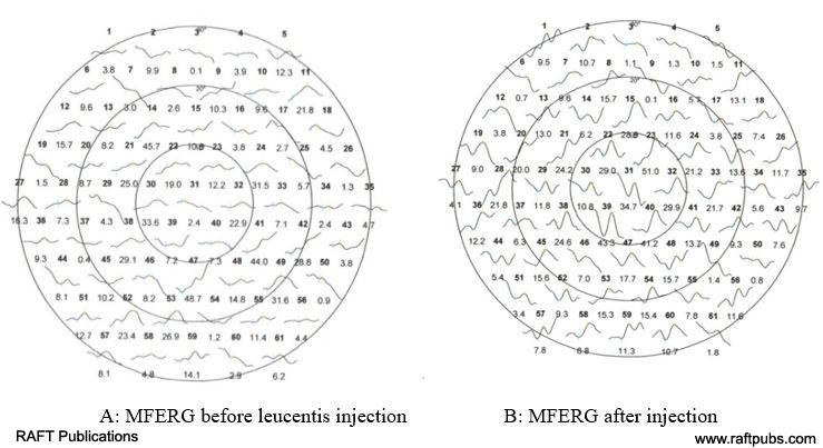 irjo1009_figure3