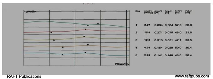 irjo1009_figure4a