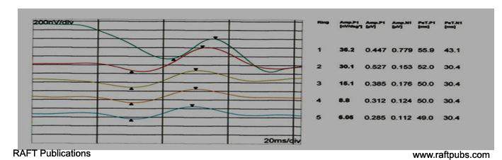 irjo1009_figure4b