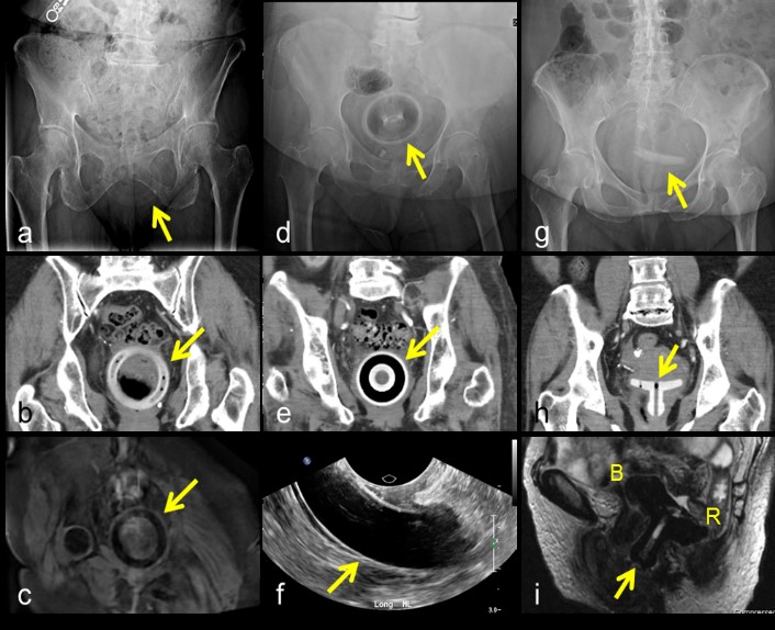 ojrmi1002-figure4